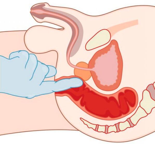 stimulatie van de G-spot bij een man via de anus